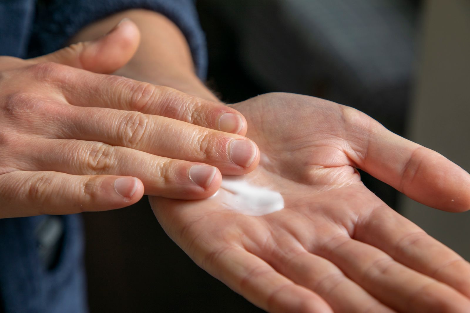 Händer med handkräm i handflatan